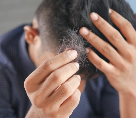 “자꾸 머리가 빠져요”…초여름 탈모, 일시적인 현상일까? a man is combing his hair with his hands