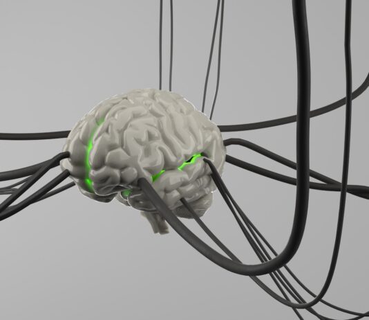 일상 속에서 챙기는 뇌 건강…작은 습관이 미래를 바꾼다 A computer generated image of a brain surrounded by wires